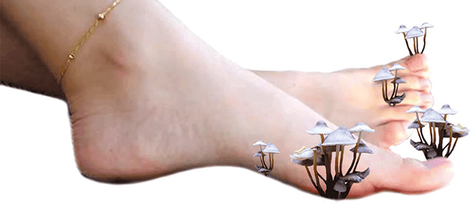 kërpudhat në këmbë